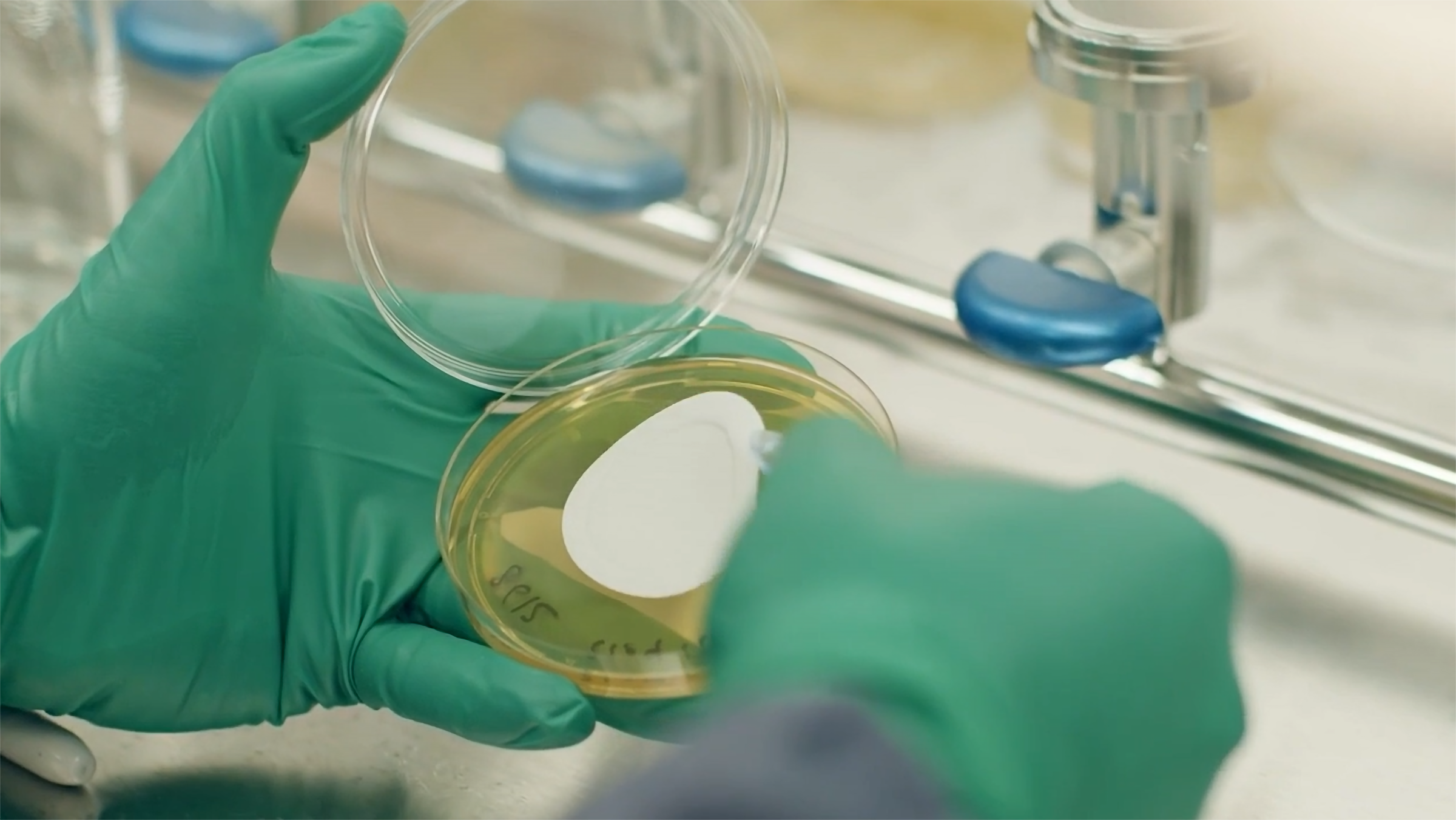 surgical gloved hands handling petri dish